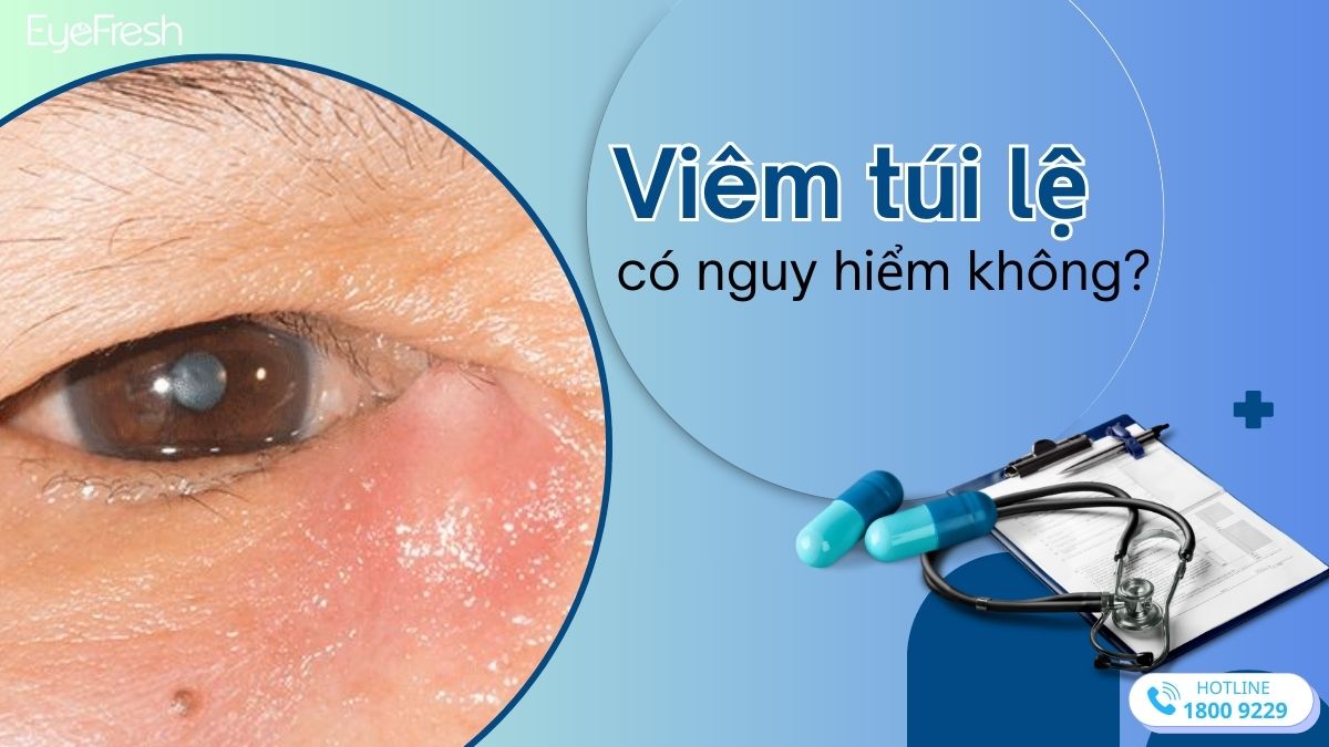 Viêm túi lệ có nguy hiểm không?